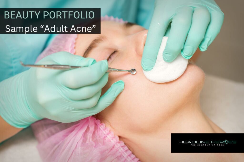 Beauty Portfolio Post - Example article about Adult Acne - by Bridget Langhoff and the Headline Heroes USA